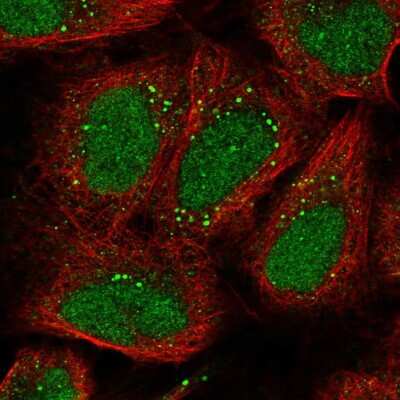 Immunocytochemistry/ Immunofluorescence: EXOC6 Antibody [NBP2-56157]