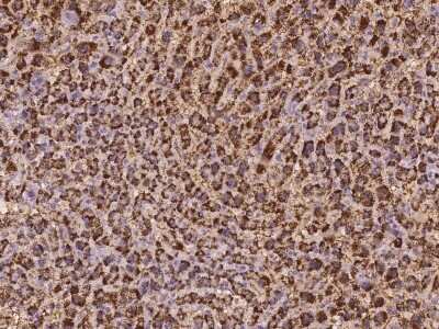 Immunohistochemistry-Paraffin: EXOC6 Antibody [NBP3-06304]