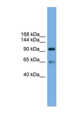 Western Blot: EXOC6 Antibody [NBP1-55468]