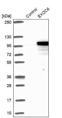 Western Blot: EXOC6 Antibody [NBP1-85031]