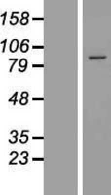 Western Blot: EXOC6 Overexpression Lysate [NBL1-10381]