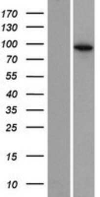 Western Blot: EXOC6B Overexpression Lysate [NBP2-10291]