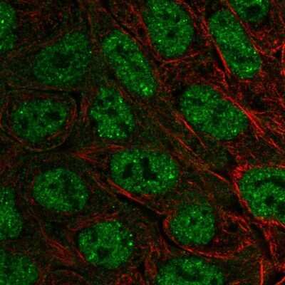 Immunocytochemistry/ Immunofluorescence: EXOC6B Antibody [NBP2-56692]