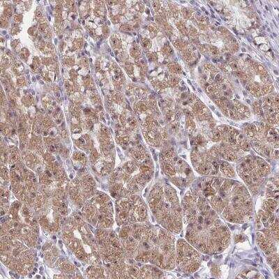 Immunohistochemistry-Paraffin: EXOC6B Antibody [NBP2-31869]