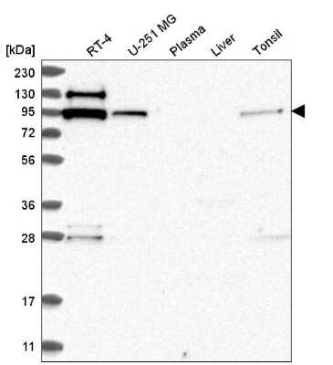 Western Blot: EXOC6B Antibody [NBP2-56692]