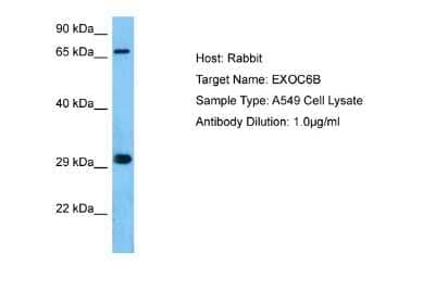 Western Blot: EXOC6B Antibody [NBP2-87378]