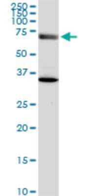 Western Blot: EXOC7 Antibody (1B7) [H00023265-M05]