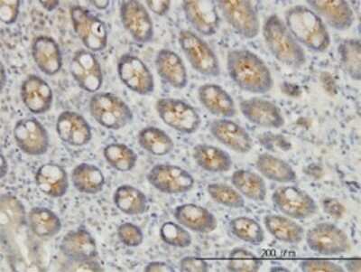 Immunohistochemistry-Paraffin: EXOC7 Antibody (1D4) [H00023265-M01]