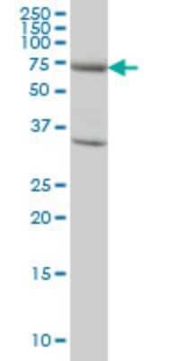 Western Blot: EXOC7 Antibody (1D4) [H00023265-M01]