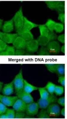 Immunocytochemistry/ Immunofluorescence: EXOC7 Antibody [NBP1-33333]