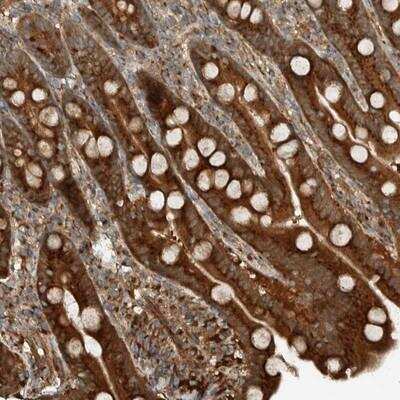 Immunohistochemistry-Paraffin: EXOC7 Antibody [NBP1-84766]