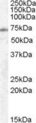 Western Blot: EXOC7 Antibody [NB100-94901]