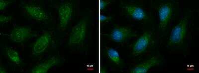 Immunocytochemistry/ Immunofluorescence: EXOC8 Antibody [NBP2-43533]