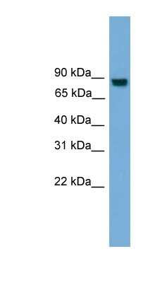 Western Blot: EXOC8 Antibody [NBP1-91444]