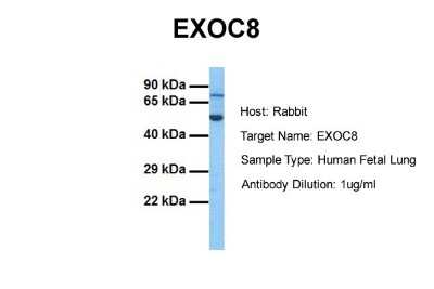 Western Blot: EXOC8 Antibody [NBP1-91444]