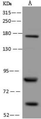 Western Blot: EXOC8 Antibody [NBP3-12607]