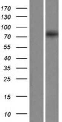 Western Blot: EXOC8 Overexpression Lysate [NBP2-05044]