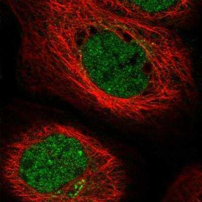 Immunocytochemistry/ Immunofluorescence: EXOD1 Antibody [NBP2-34000]