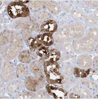 Immunohistochemistry: EXOD1 Antibody [NBP2-34000]