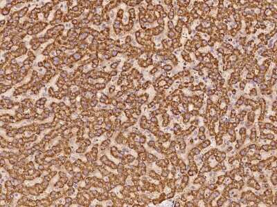 Immunohistochemistry-Paraffin: EXOD1 Antibody [NBP2-97773]