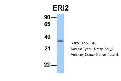 Western Blot: EXOD1 Antibody [NBP1-55303]