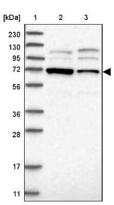 Western Blot: EXOD1 Antibody [NBP1-87941]