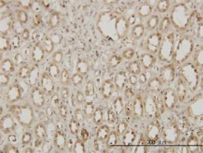 Immunohistochemistry-Paraffin: EXOSC3 Antibody (5C3) [H00051010-M03]