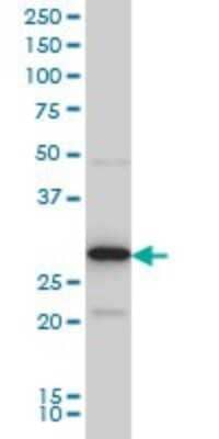 Western Blot: EXOSC3 Antibody (5C3) [H00051010-M03]