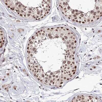 Immunohistochemistry-Paraffin: EXOSC3 Antibody [NBP1-91874]