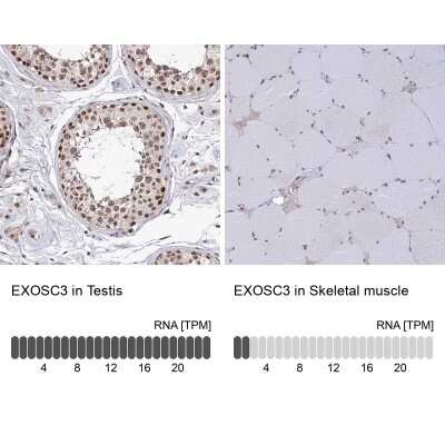 Immunohistochemistry-Paraffin: EXOSC3 Antibody [NBP1-91874]