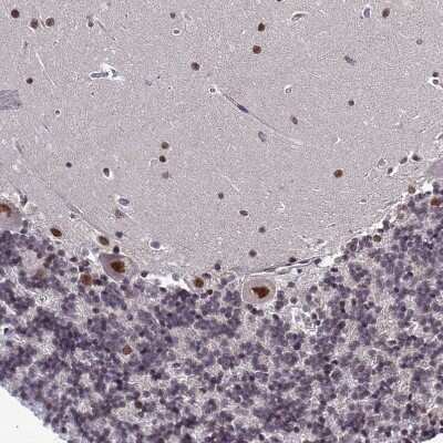 Immunohistochemistry-Paraffin: EXOSC3 Antibody [NBP1-91874]