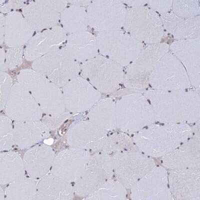 Immunohistochemistry-Paraffin: EXOSC3 Antibody [NBP1-91874]