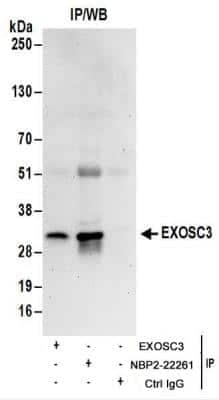 Immunoprecipitation: EXOSC3 Antibody [NBP2-22261]