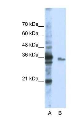 Western Blot: EXOSC3 Antibody [NBP1-57209]