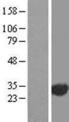 Western Blot: EXOSC3 Overexpression Lysate [NBL1-10385]