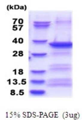 SDS-PAGE: Recombinant Human EXOSC3 His Protein [NBP2-51715]