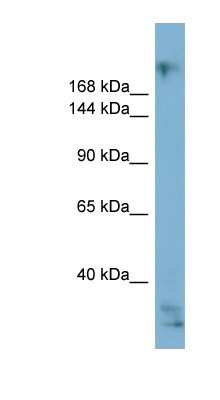 Western Blot: EXPH5 Antibody [NBP1-80506]