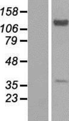 Western Blot: Exostosin-like 2/EXTL2 Overexpression Lysate [NBP2-08620]