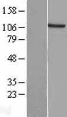 Western Blot: Exostosin-like 3/EXTL3 Overexpression Lysate [NBL1-10395]