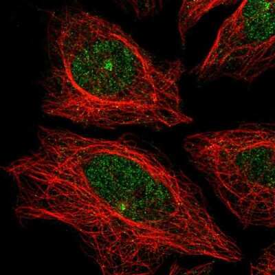 Immunocytochemistry/ Immunofluorescence: EY Cadherin Antibody [NBP2-68829]