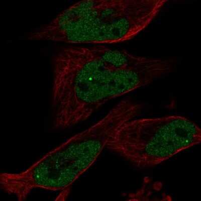 Immunocytochemistry/ Immunofluorescence: EYA1 Antibody [NBP2-58069]