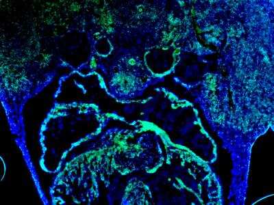 Immunohistochemistry-Frozen: EYA1 Antibody [NBP2-58069]