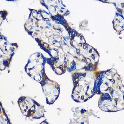 Immunohistochemistry-Paraffin: EYA1 Antibody - Azide and BSA Free [NBP3-04365]