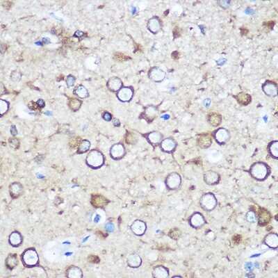 Immunohistochemistry-Paraffin: EYA1 Antibody - Azide and BSA Free [NBP3-04365]