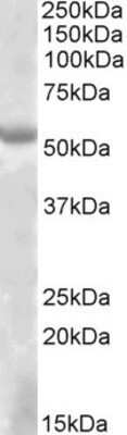 Western Blot: EYA1 Antibody [NBP1-46136]