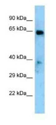 Western Blot: EYA1 Antibody [NBP1-98347]