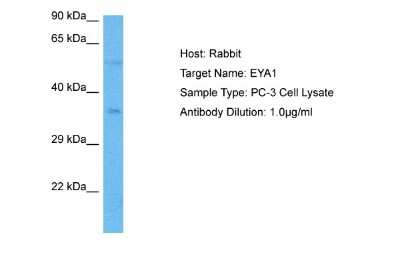 Western Blot: EYA1 Antibody [NBP2-87382]