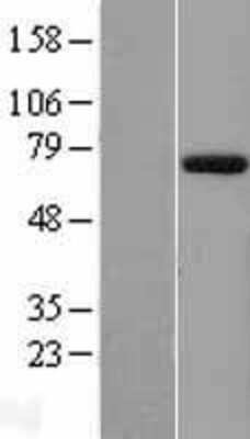 Western Blot: EYA1 Overexpression Lysate [NBP2-05187]