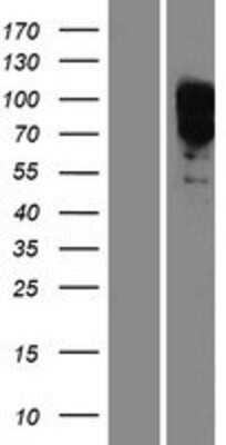 Western Blot: EYA1 Overexpression Lysate [NBP2-05189]