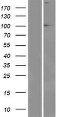 Western Blot: EYA1 Overexpression Lysate [NBP2-10017]